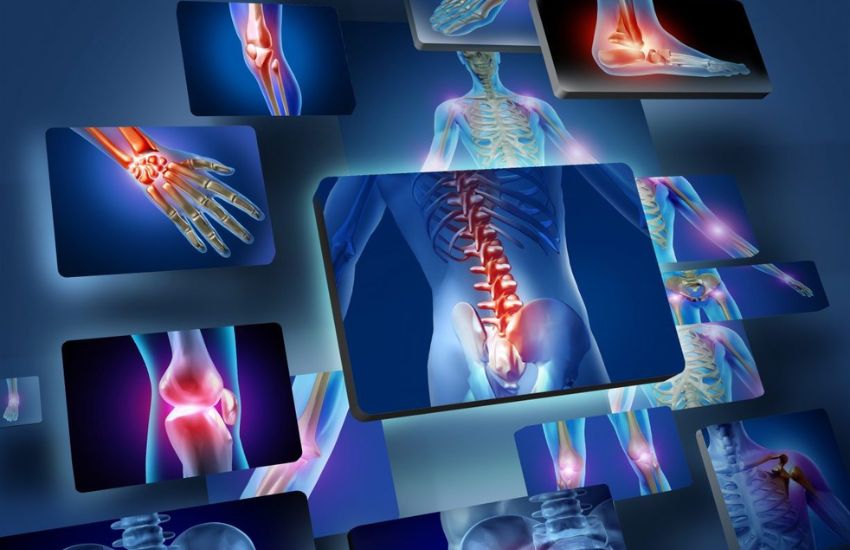 joint-replacement